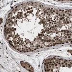 Atlas Antibodies Anti-WIZ Antibody