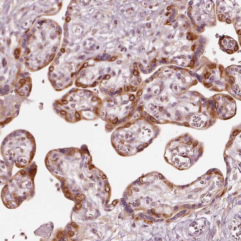 Atlas Antibodies Anti-WLS Antibody