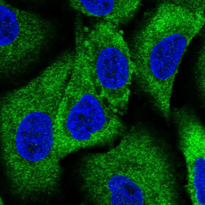 Atlas Antibodies Anti-WNK1 Antibody
