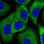 Atlas Antibodies Anti-WNK1 Antibody