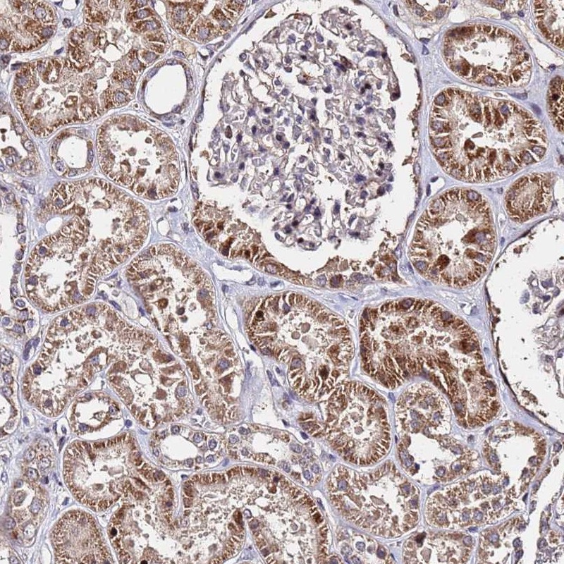 Atlas Antibodies Anti-WNK4 Antibody