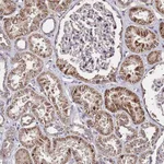 Atlas Antibodies Anti-WNK4 Antibody