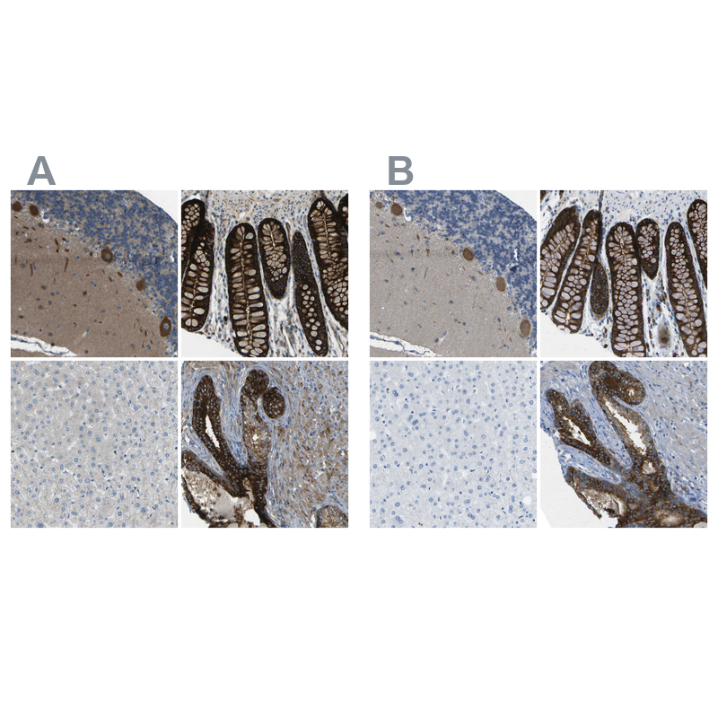 Atlas Antibodies Anti-WNK2 Antibody