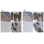 Atlas Antibodies Anti-WNK2 Antibody
