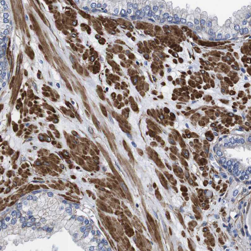 Atlas Antibodies Anti-WNT10A Antibody