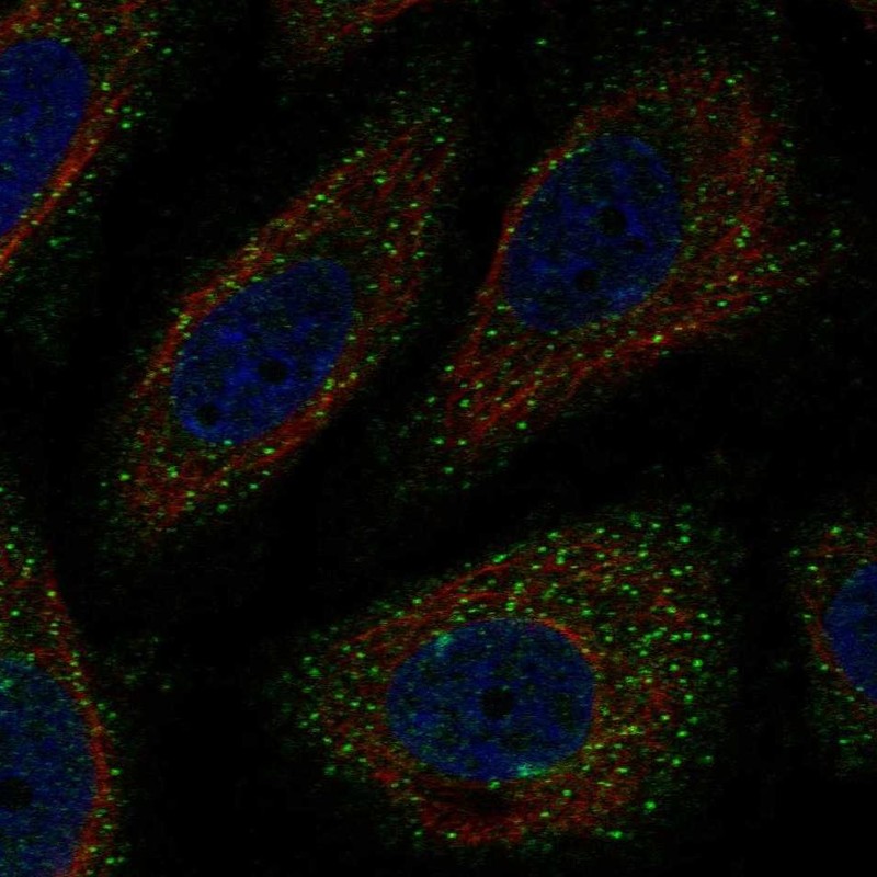 Atlas Antibodies Anti-WNK3 Antibody