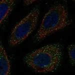 Atlas Antibodies Anti-WNK3 Antibody