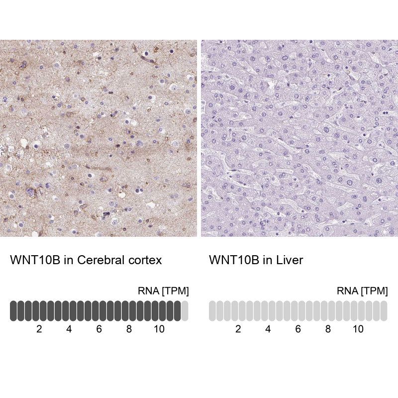 Atlas Antibodies Anti-WNT10B Antibody