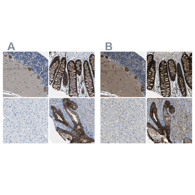 Atlas Antibodies Anti-WNK2 Antibody