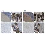 Atlas Antibodies Anti-WNK2 Antibody