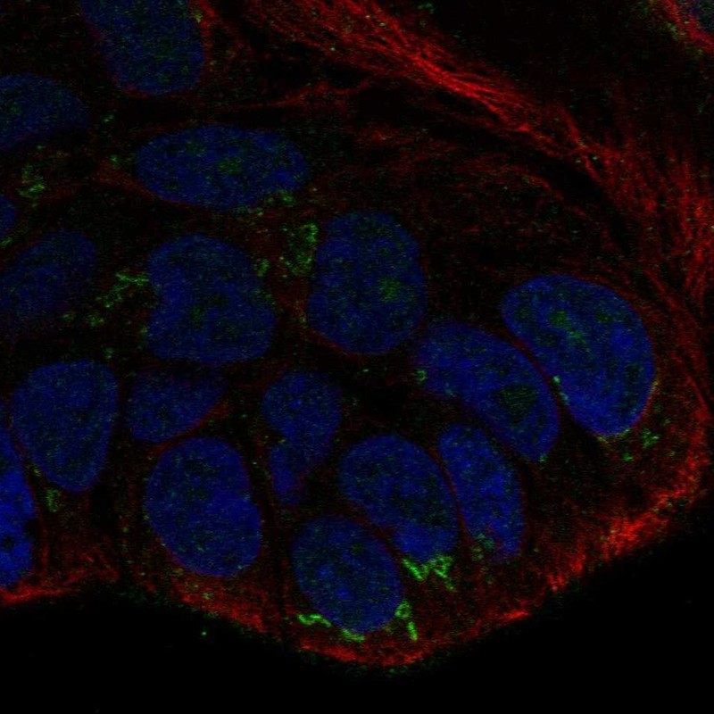 Atlas Antibodies Anti-WNT10B Antibody