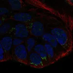 Atlas Antibodies Anti-WNT10B Antibody