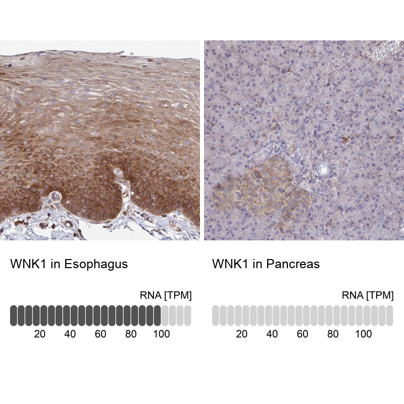 Atlas Antibodies Anti-WNK1 Antibody