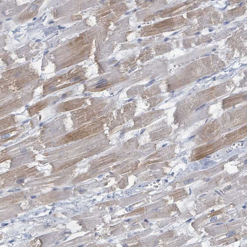 Atlas Antibodies Anti-WNT11 Antibody