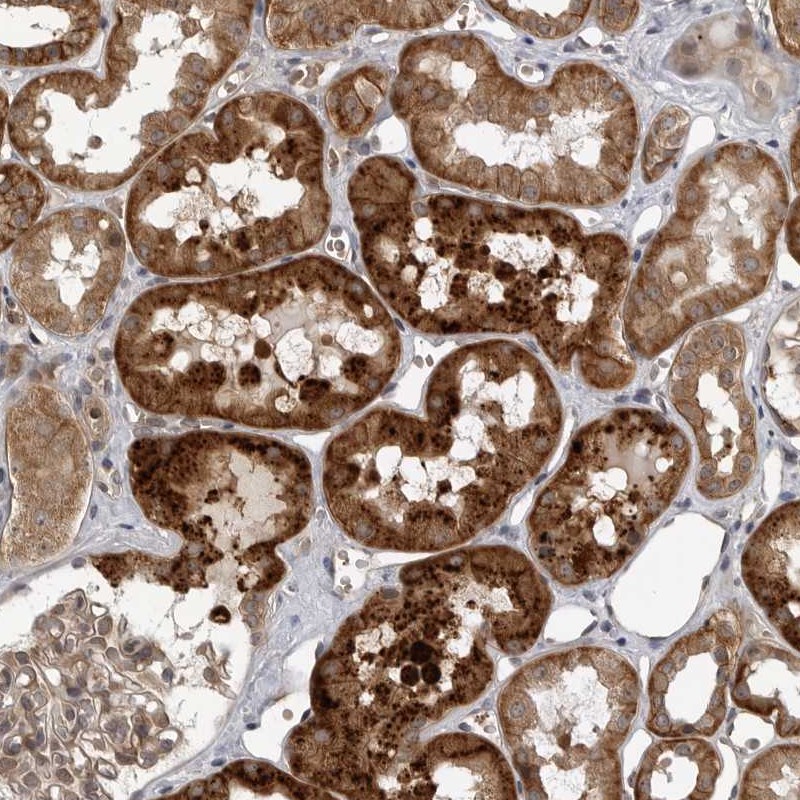 Atlas Antibodies Anti-WNT16 Antibody