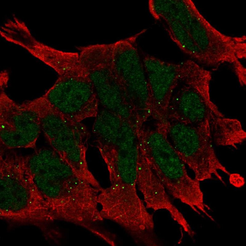 Atlas Antibodies Anti-WNT2B Antibody