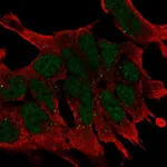 Atlas Antibodies Anti-WNT2B Antibody