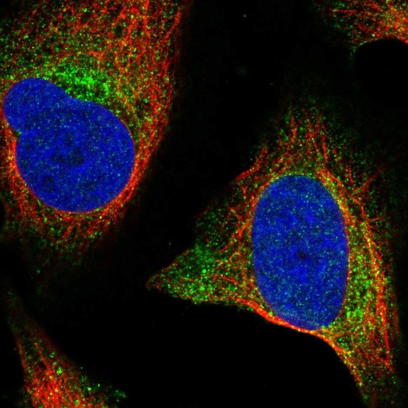 Atlas Antibodies Anti-WNT2B Antibody