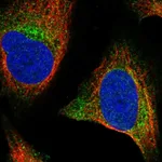 Atlas Antibodies Anti-WNT2B Antibody