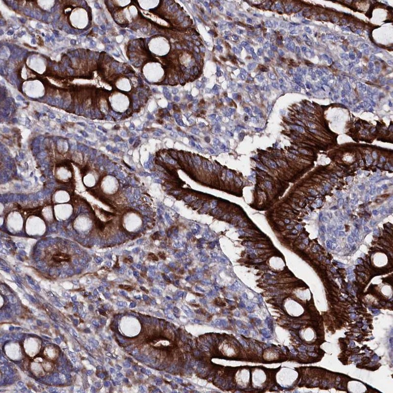 Atlas Antibodies Anti-WNT8A Antibody