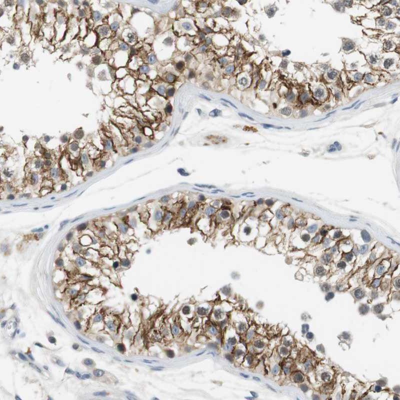 Atlas Antibodies Anti-WNT7A Antibody