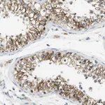 Atlas Antibodies Anti-WNT7A Antibody