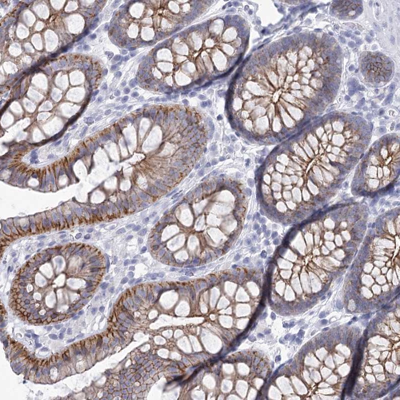 Atlas Antibodies Anti-WNT8B Antibody