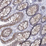 Atlas Antibodies Anti-WNT8B Antibody
