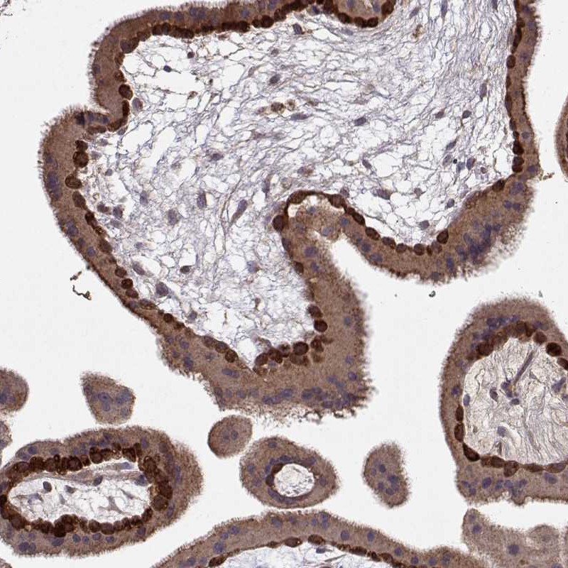 Atlas Antibodies Anti-WNT6 Antibody
