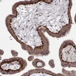 Atlas Antibodies Anti-WNT6 Antibody