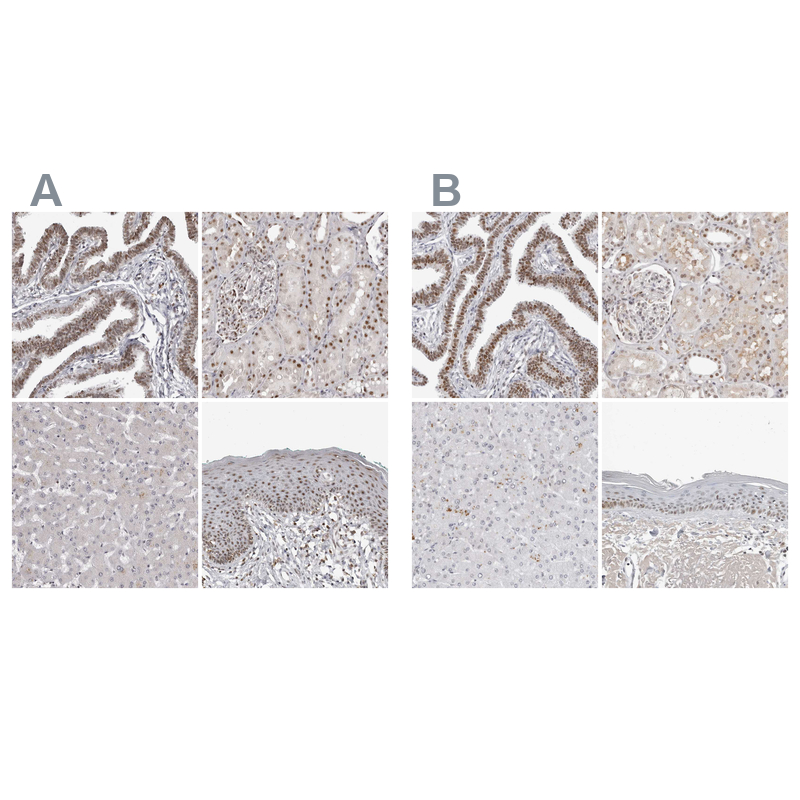 Atlas Antibodies Anti-WRAP53 Antibody