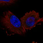 Atlas Antibodies Anti-WRAP53 Antibody