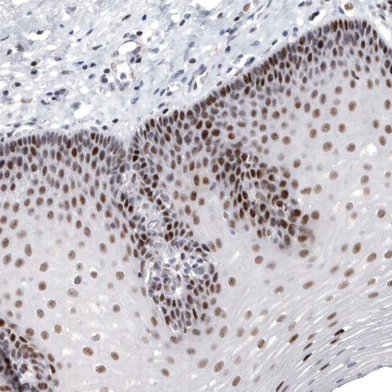 Atlas Antibodies Anti-WRAP73 Antibody