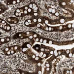 Atlas Antibodies Anti-WRB Antibody