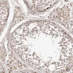 Atlas Antibodies Anti-WRN Antibody