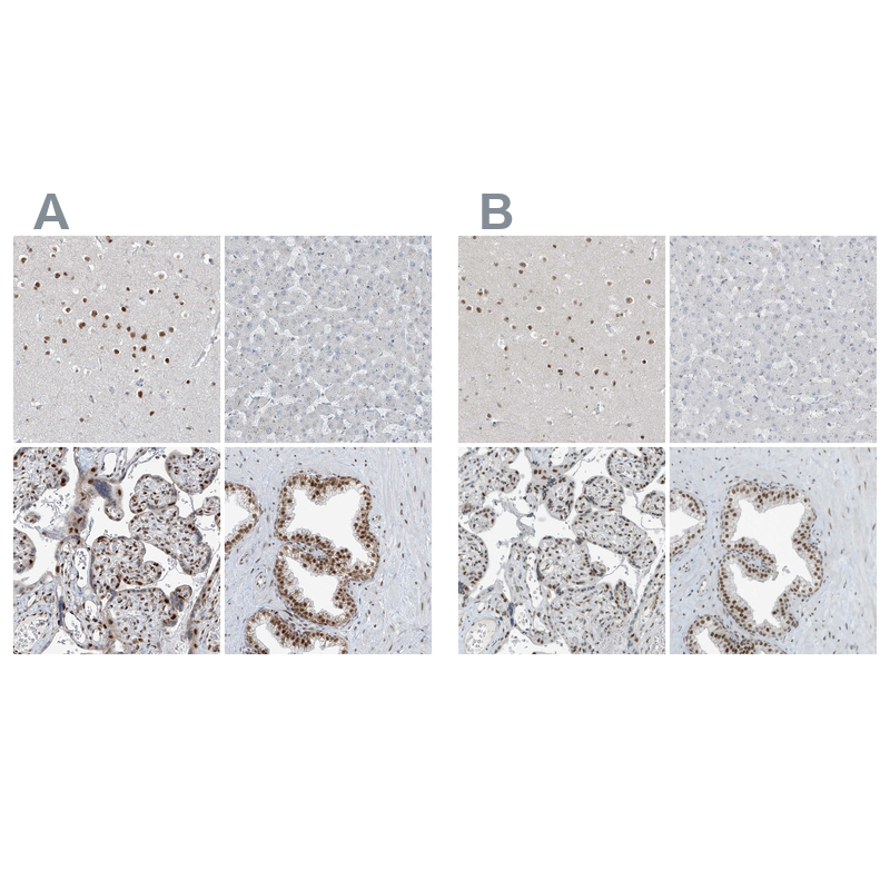 Atlas Antibodies Anti-WRNIP1 Antibody