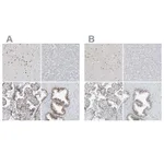 Atlas Antibodies Anti-WRNIP1 Antibody