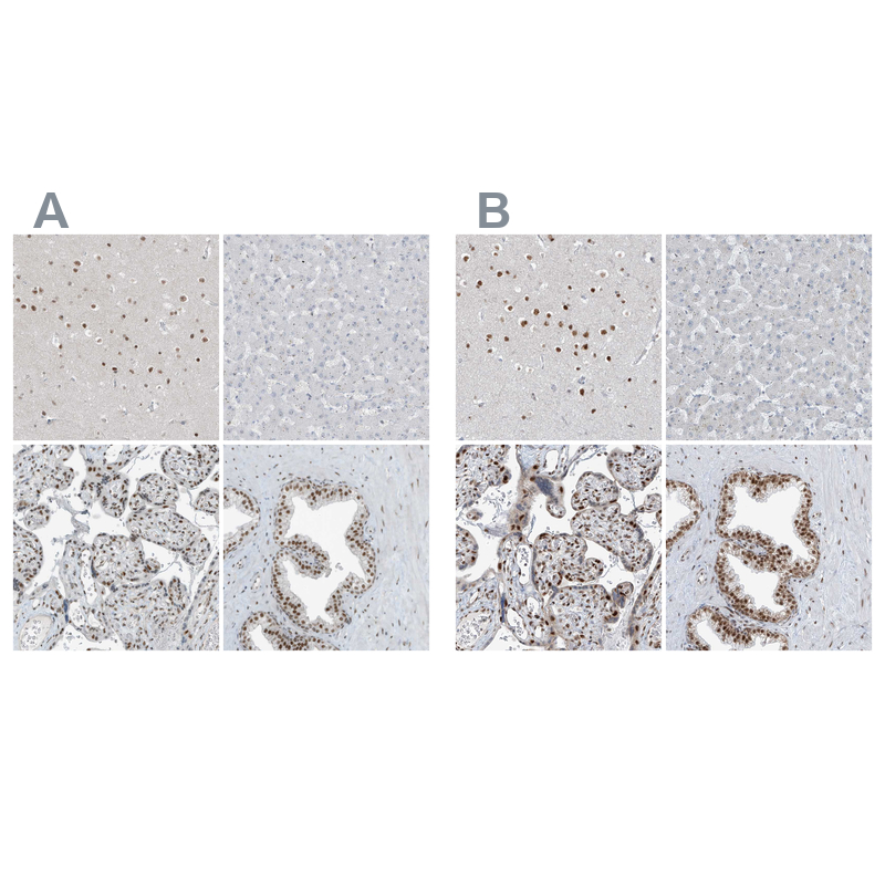 Atlas Antibodies Anti-WRNIP1 Antibody