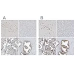 Atlas Antibodies Anti-WRNIP1 Antibody