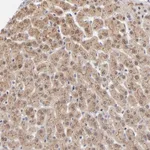 Atlas Antibodies Anti-WSB1 Antibody