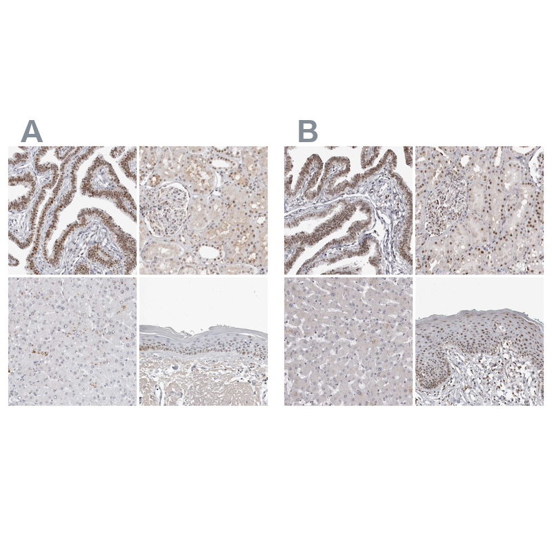 Atlas Antibodies Anti-WRAP53 Antibody