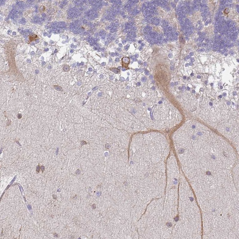 Atlas Antibodies Anti-WSB2 Antibody