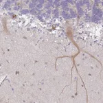 Atlas Antibodies Anti-WSB2 Antibody