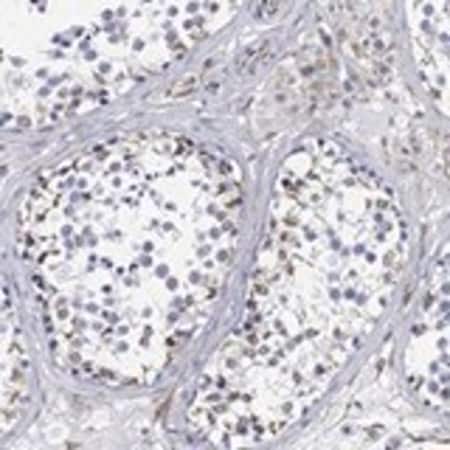 Merck Anti-PSKH2 antibody produced in rabbit