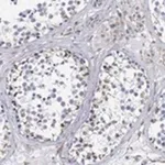 Merck Anti-PSKH2 antibody produced in rabbit