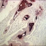 Merck MONOCLONAL ANTI-CARCINOEMBRYONIC ANTIGE&