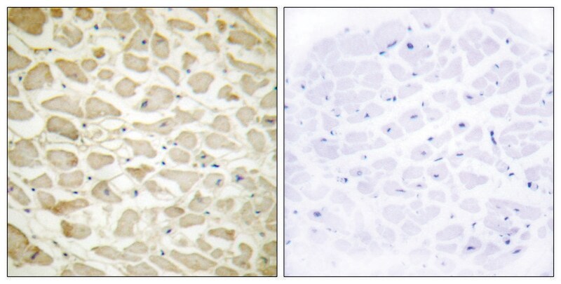 Merck Anti-Collagen XIV alpha1, N-Terminal antibody produced in rabbit