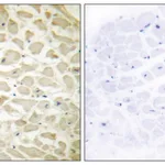 Merck Anti-Collagen XIV alpha1, N-Terminal antibody produced in rabbit