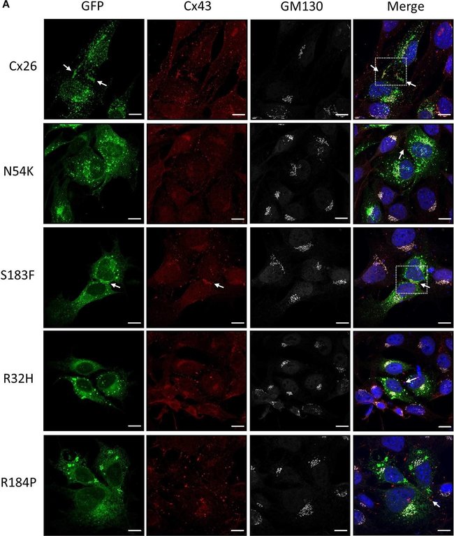 Thermo Fisher Scientific Goat anti-Mouse IgG (H+L) Cross-Adsorbed Secondary Antibody, Alexa Fluor 555