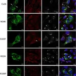 Thermo Fisher Scientific Goat anti-Mouse IgG (H+L) Cross-Adsorbed Secondary Antibody, Alexa Fluor 555